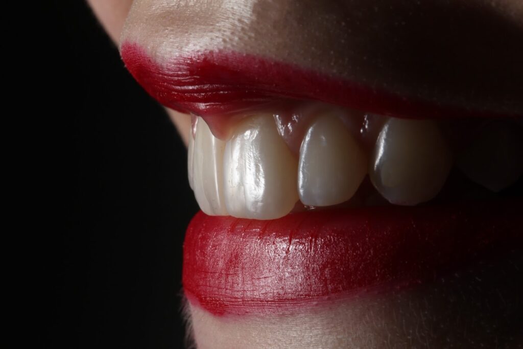 Dental Implants & Tooth Replacement